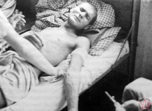 Узник концлагеря Дахау во время медицинского эксперимента