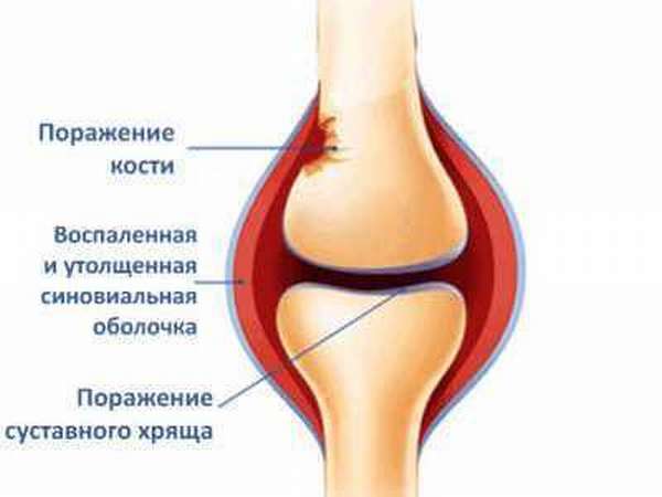 Реферат: Строение коленного сустава